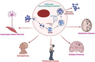 Chlamydia pneumoniae in Alzheimer's disease pathology
